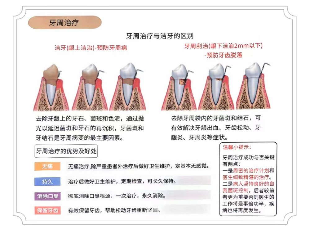 牙周治疗